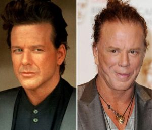 Mickey-Rourke-Before-And-After-Plastic-Surgery