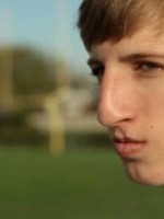 XCU of high school boy bullied for cleft lip and large nose.