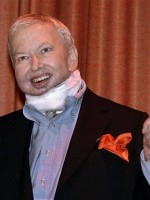 Film critic Roger Ebert after cancer surgery