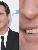 Head shot of Joaquin Phoenix + cleft lip closeup.