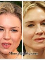 Close up of 2 Renee Zellweger face shots in lookism Before & After sc.com